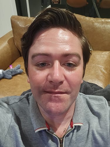 Customer photo review of Seb Natural Calming Serum