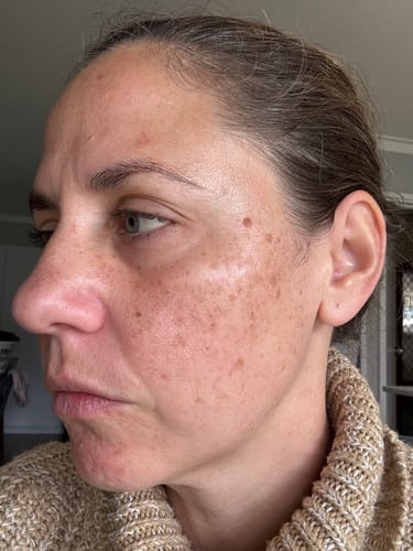 Customer photo review of Sea Cucumber Collagen Regeneration Serum