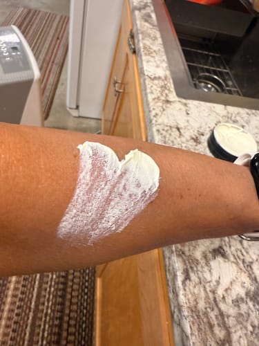 Customer photo review of S-Balm - Tallow and Zinc Sun Lotion - 2 oz.