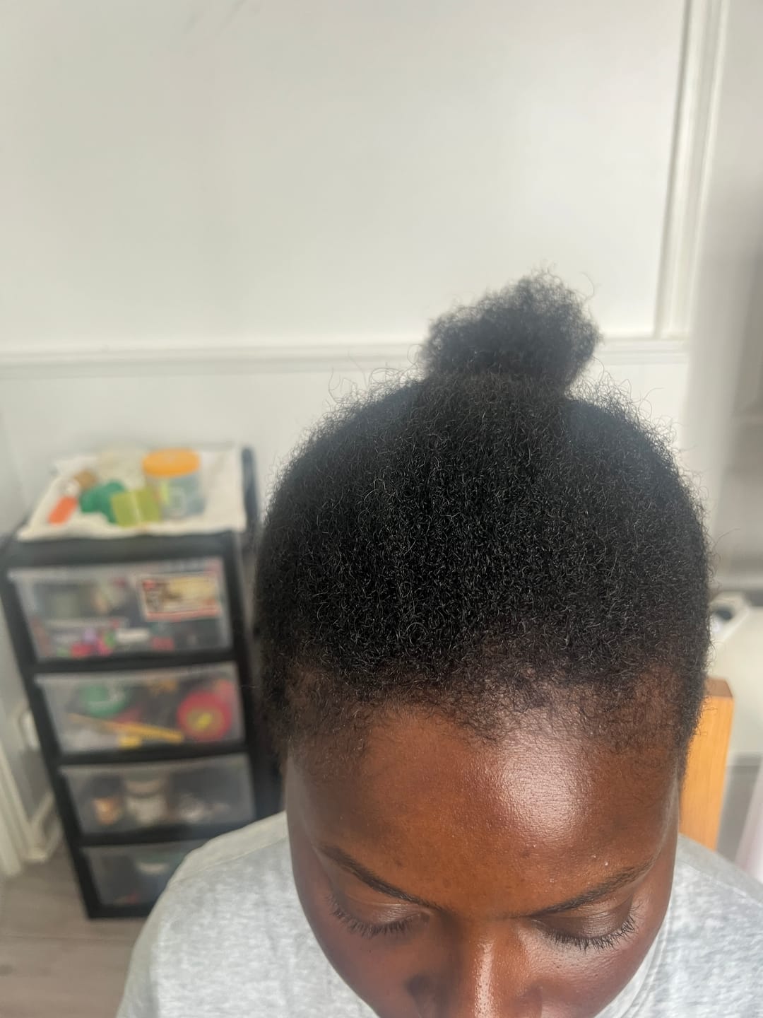 Customer photo review of Hair Recovery Bundle