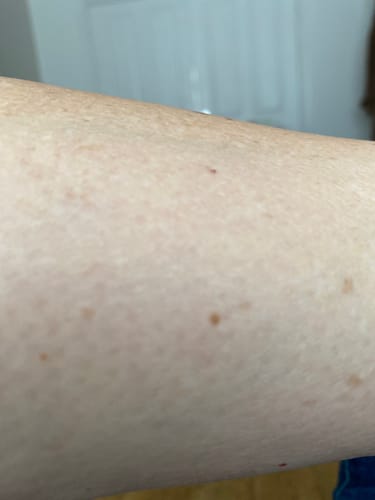 Customer photo review of Plumeria Hard Wax 1kg