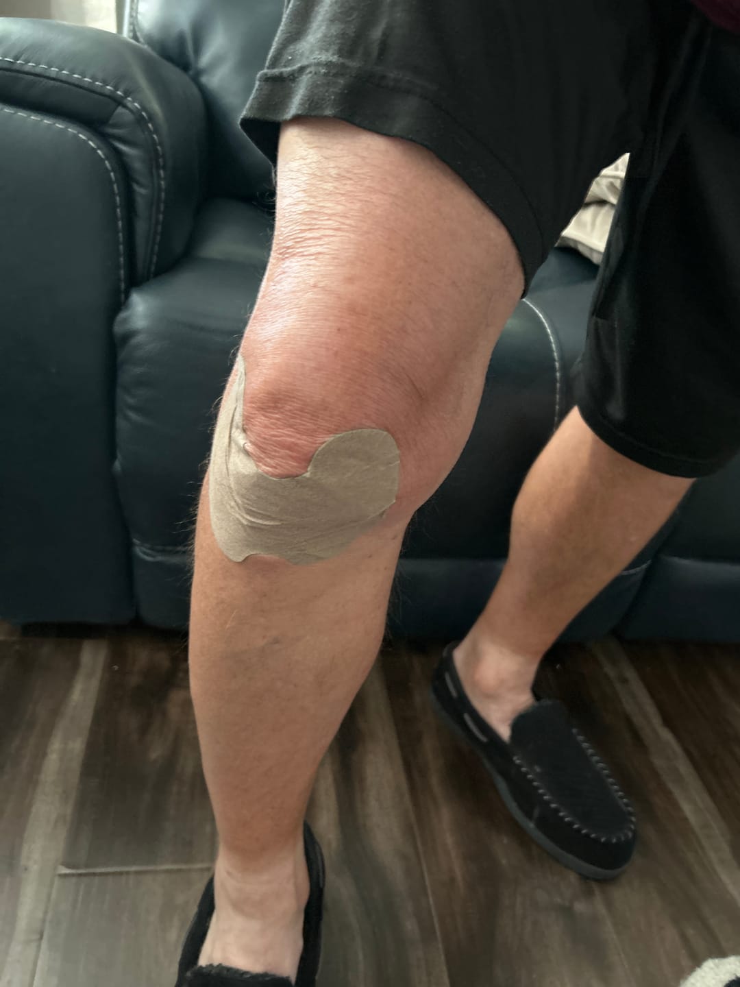 Customer photo review of Auxillium Knee Patch (fka Heaven Patch)