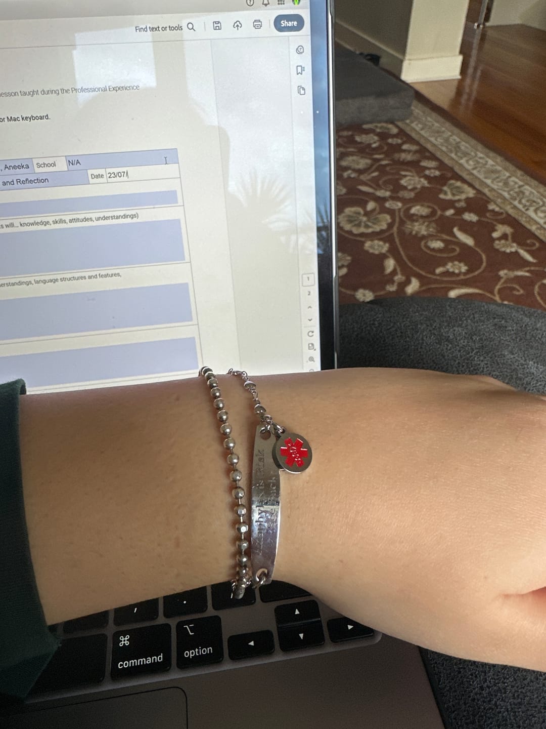 Customer photo review of Personalised Medical Alert Heart Link Bracelet