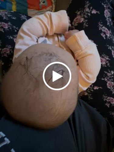 Customer video review of Happy Scalp Cream™