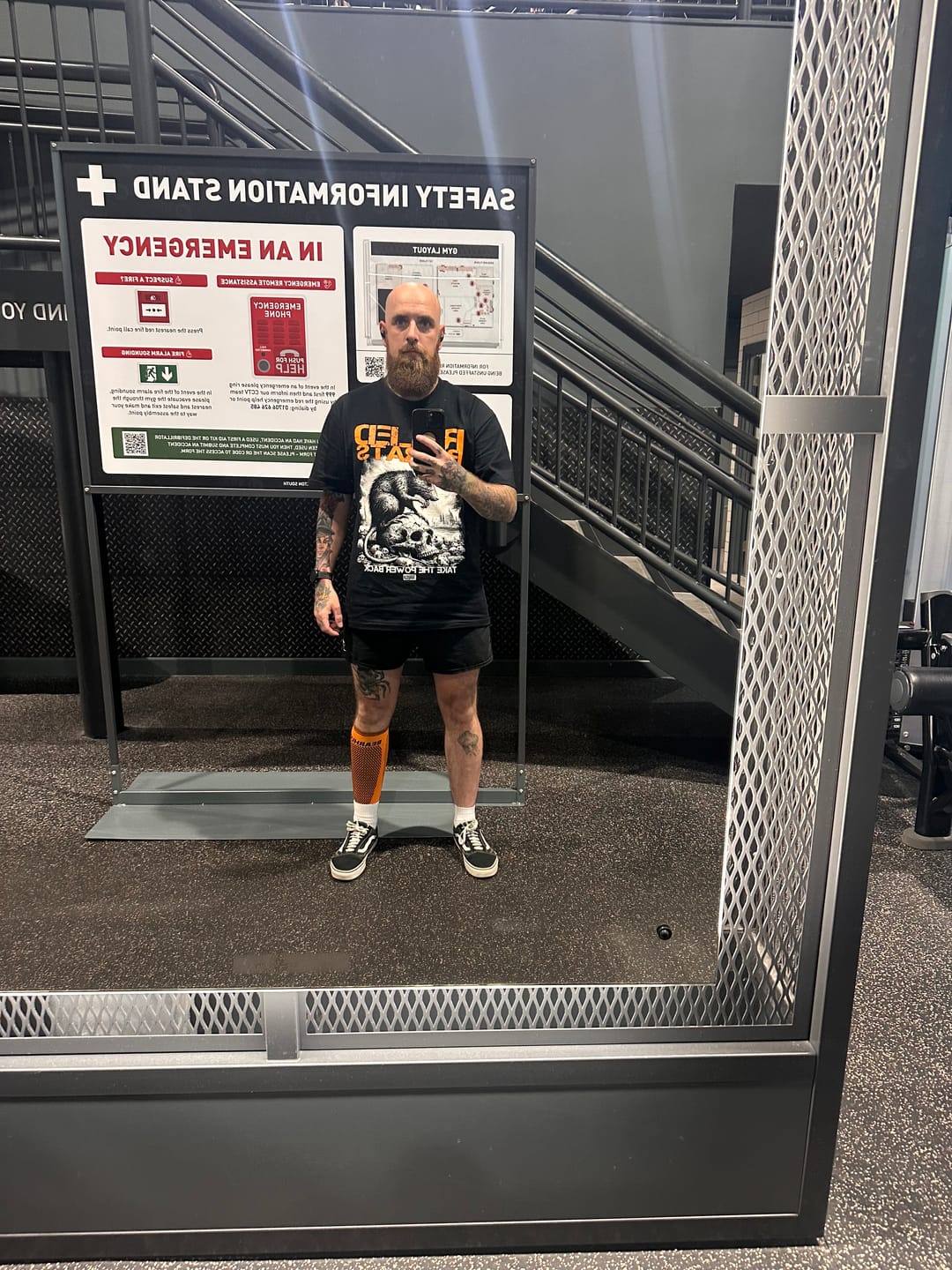 Customer photo review of Calf Compression Support Sleeve For Shin Splint Pain Relief