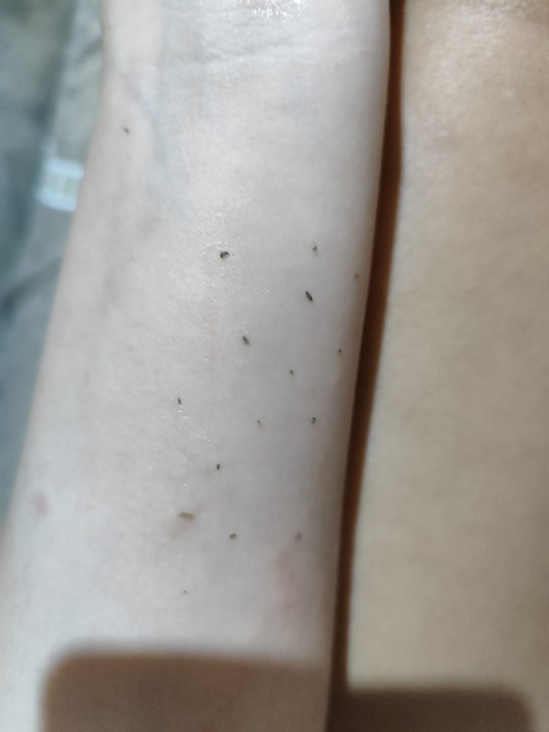 Customer photo review of Mixsoon Bean Essence | 2 En 1: Hidrata Y Limpia Poros