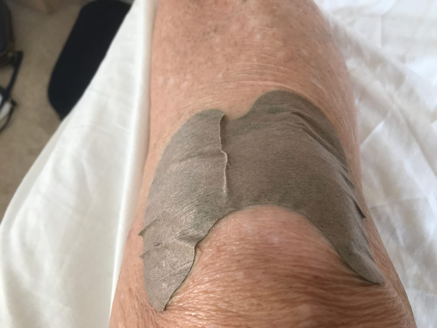 Customer photo review of Auxilium Knee Patch (fka Heaven Patch)