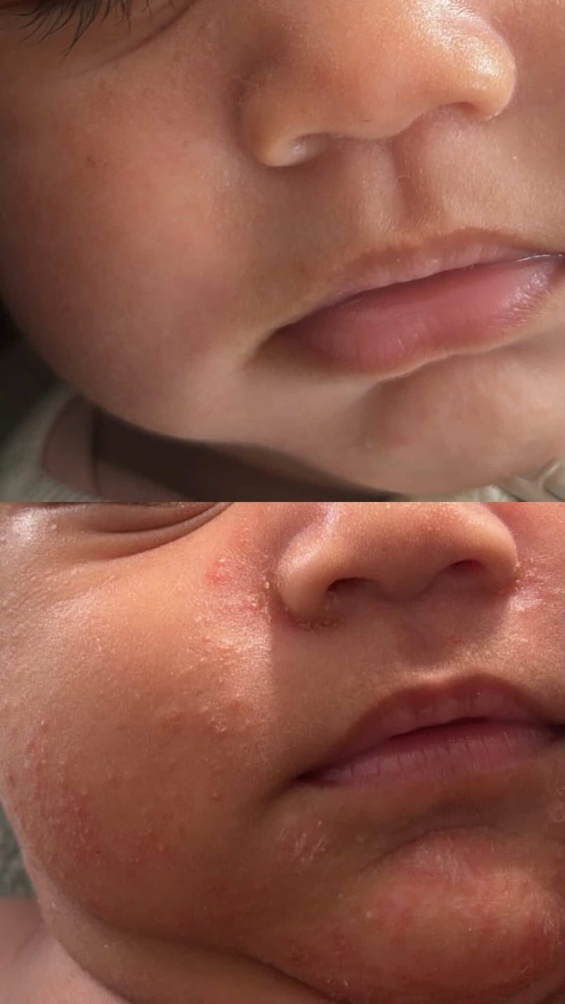 Customer photo review of Kawakawa Repair Balm - Winner, Best SOS/Healing Balm 2024