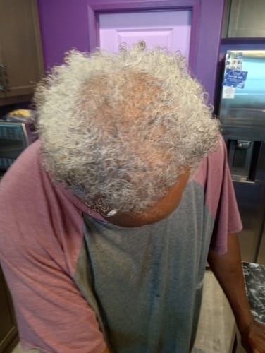 Customer photo review of Rennora Hair Growth Serum