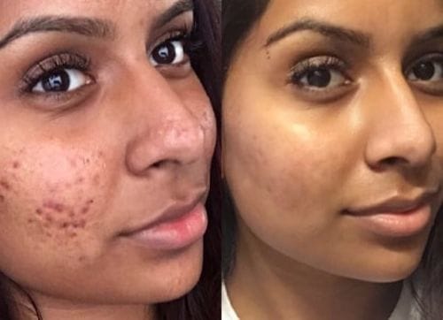 Customer photo review of Dr. Pen Ultima A6S