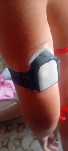 Customer photo review of Omnipod Insulin Patch Pump Adjustable Armband - Dia-Style