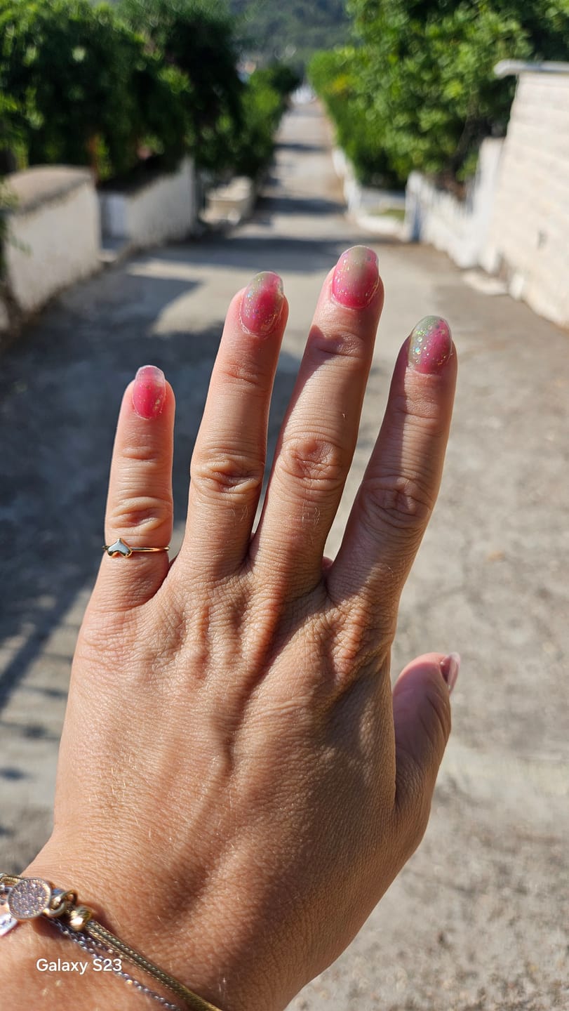 Customer photo review of N Rainbow Bomb Jel Tırnak 30 Adet, 2 Kullanım