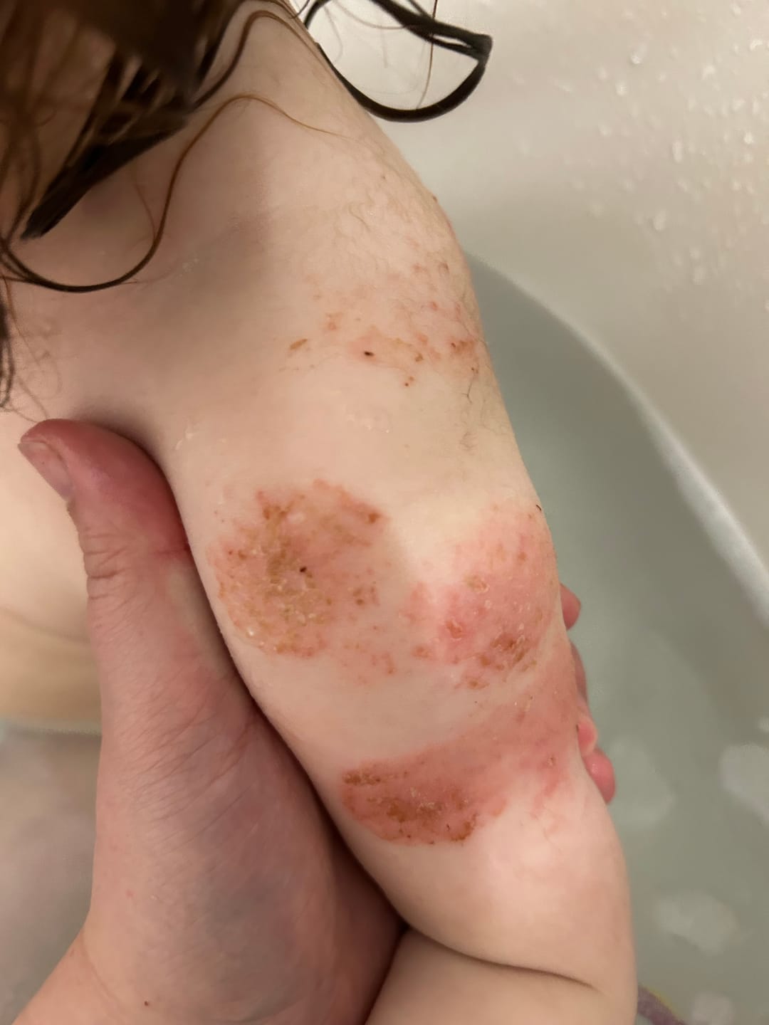 Customer photo review of Tallow and Honey Balm