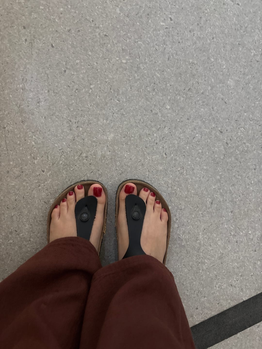 Customer photo review of P Basic Pedicure no.4 Jel Tırnak 32 Adet, 2 Kullanım