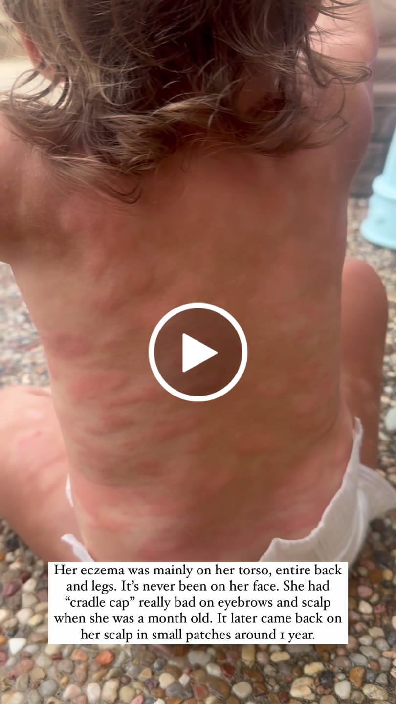 Customer video review of Children’s Gut Rebalance Kit