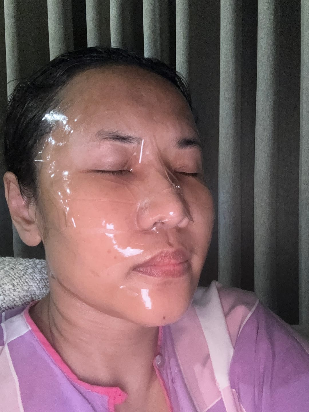 Customer photo review of Madeca Lab PDRN Skin Tightening Glow Gel Mask 1ea