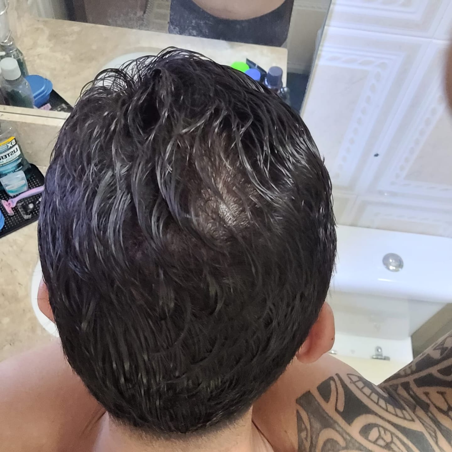 Customer photo review of Gummy Hair For Men® - Cola 180 g