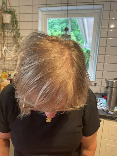 Customer photo review of Sunkissed Starter Kit