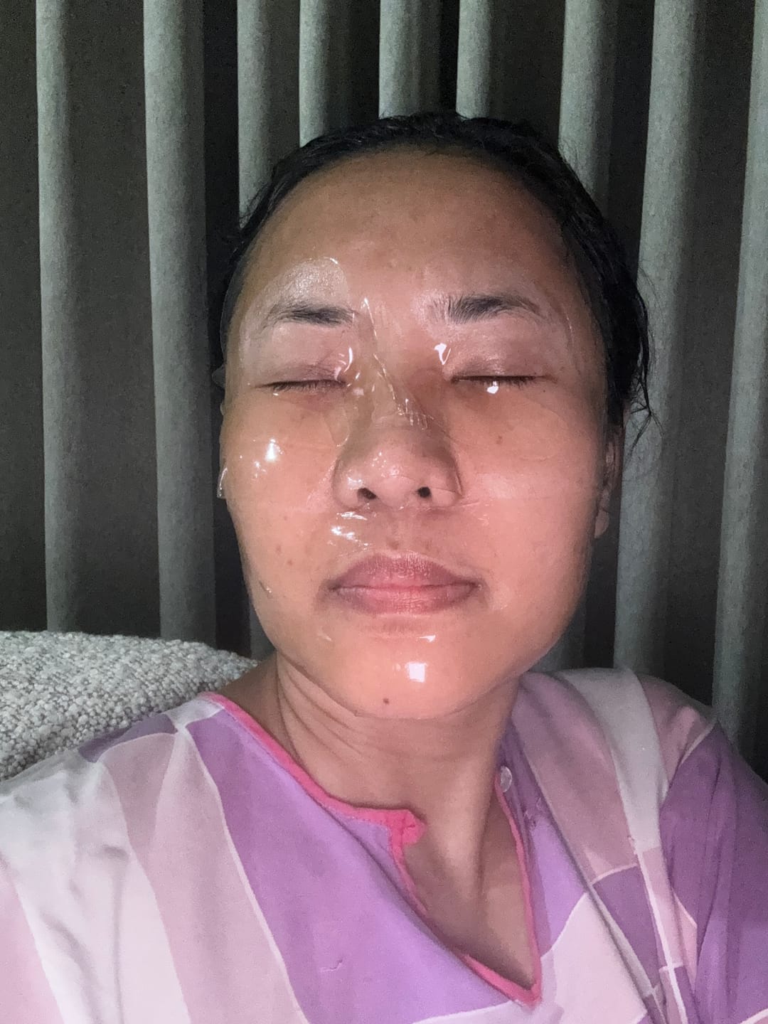 Customer photo review of PDRN Firming Boosting ampoule 30ml