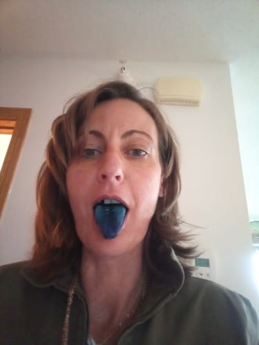 Customer photo review of (30-Day Subscription) Ultra Methylene Blue