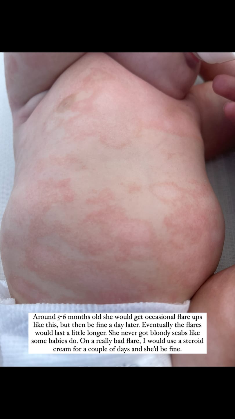 Customer photo review of Children’s Gut Rebalance Kit