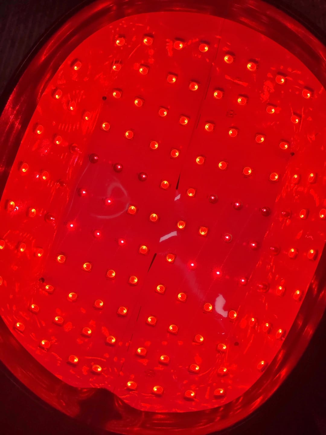 Customer photo review of LED Therapy Cap