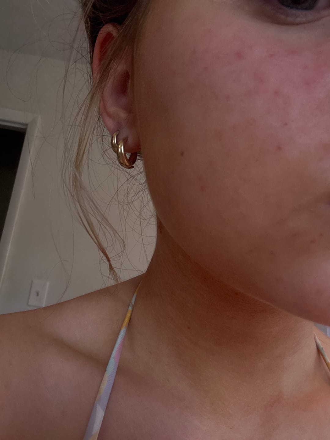 Customer photo review of Prestige Tans: Tanning Nasal Spray