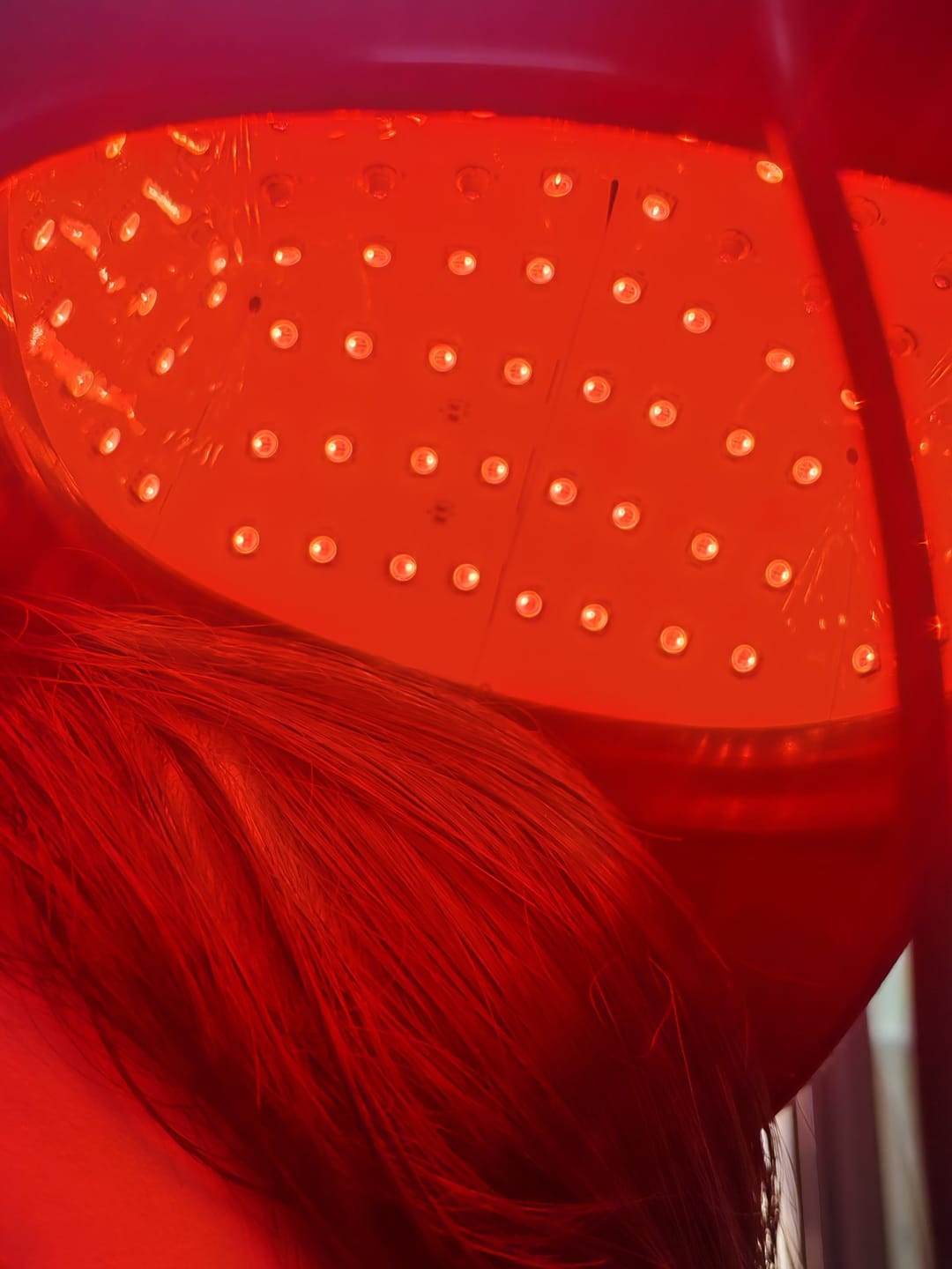Customer photo review of LED Therapy Cap