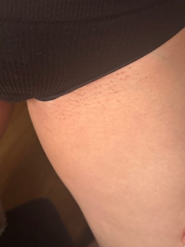 Customer photo review of Superfood Intimate Care Kit