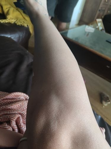 Customer photo review of Trim Pod 2.0 Women Shaver