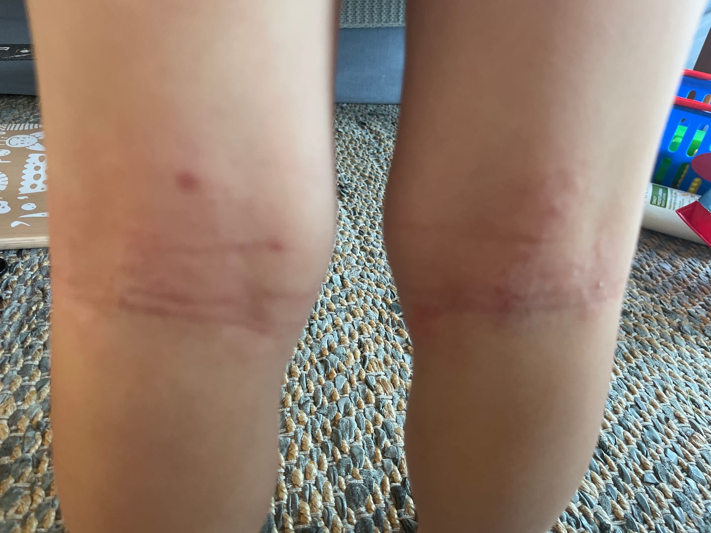 Customer photo review of Large Bioskin Junior Duo Pack