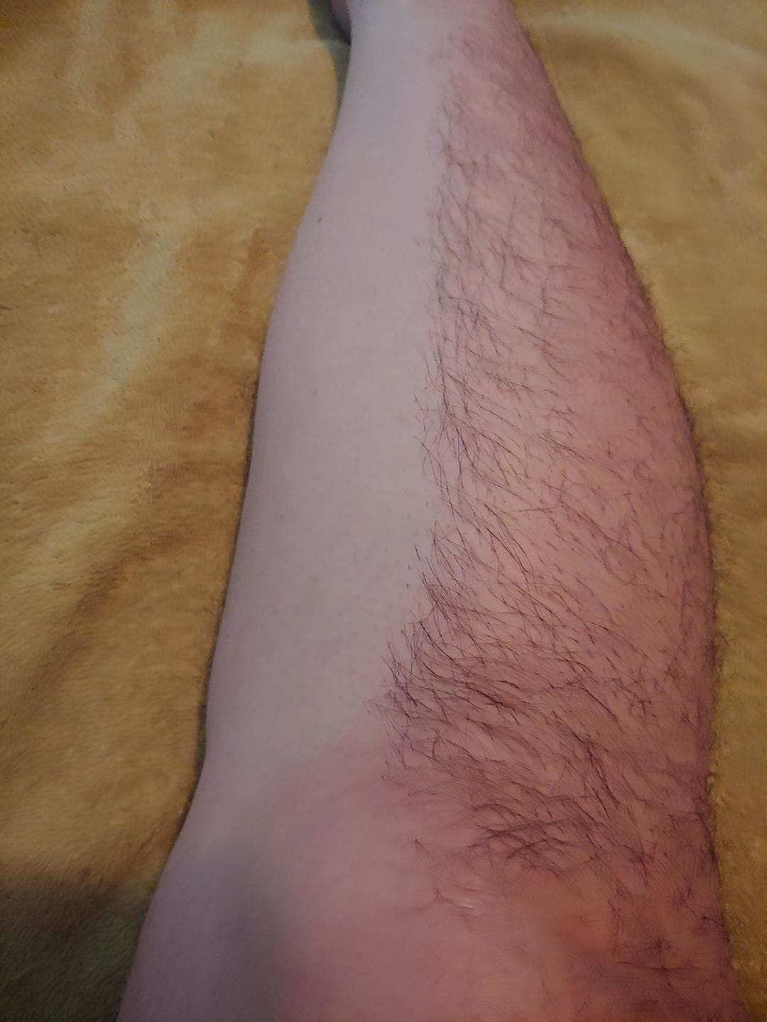 Customer photo review of Trim Pod 2.0 Women Shaver