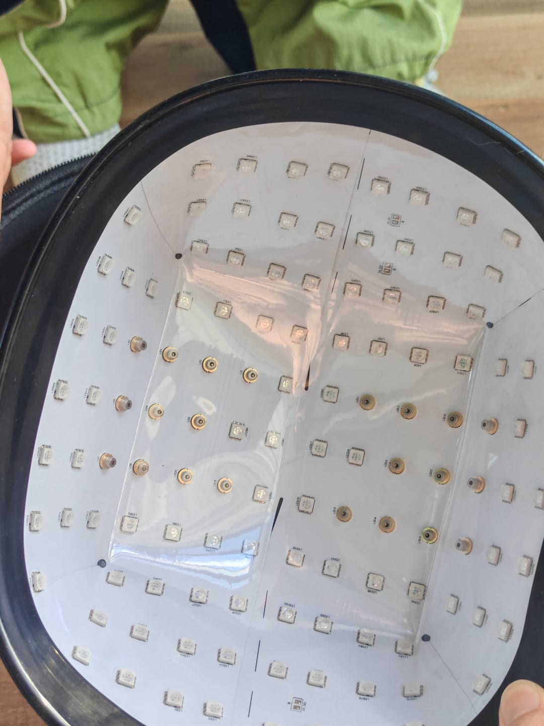Customer photo review of LED Therapy Cap