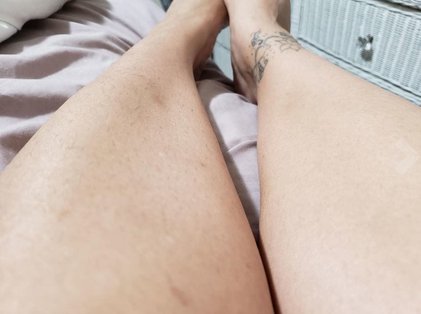 Customer photo review of Trim Pod 2.0 Women Shaver