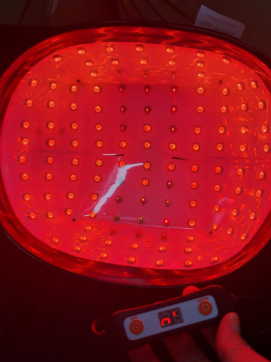 Customer photo review of LED Therapy Cap