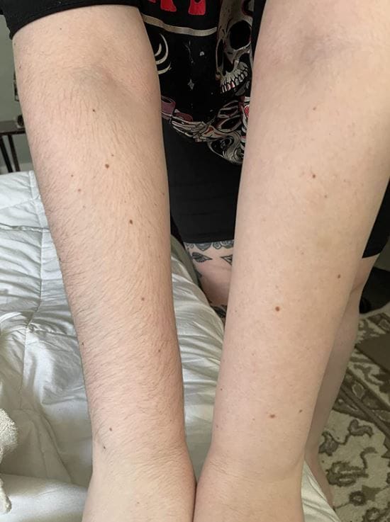Customer photo review of Trim Pod 2.0 Women Shaver