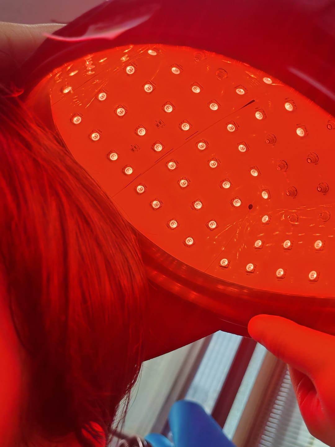 Customer photo review of LED Therapy Cap