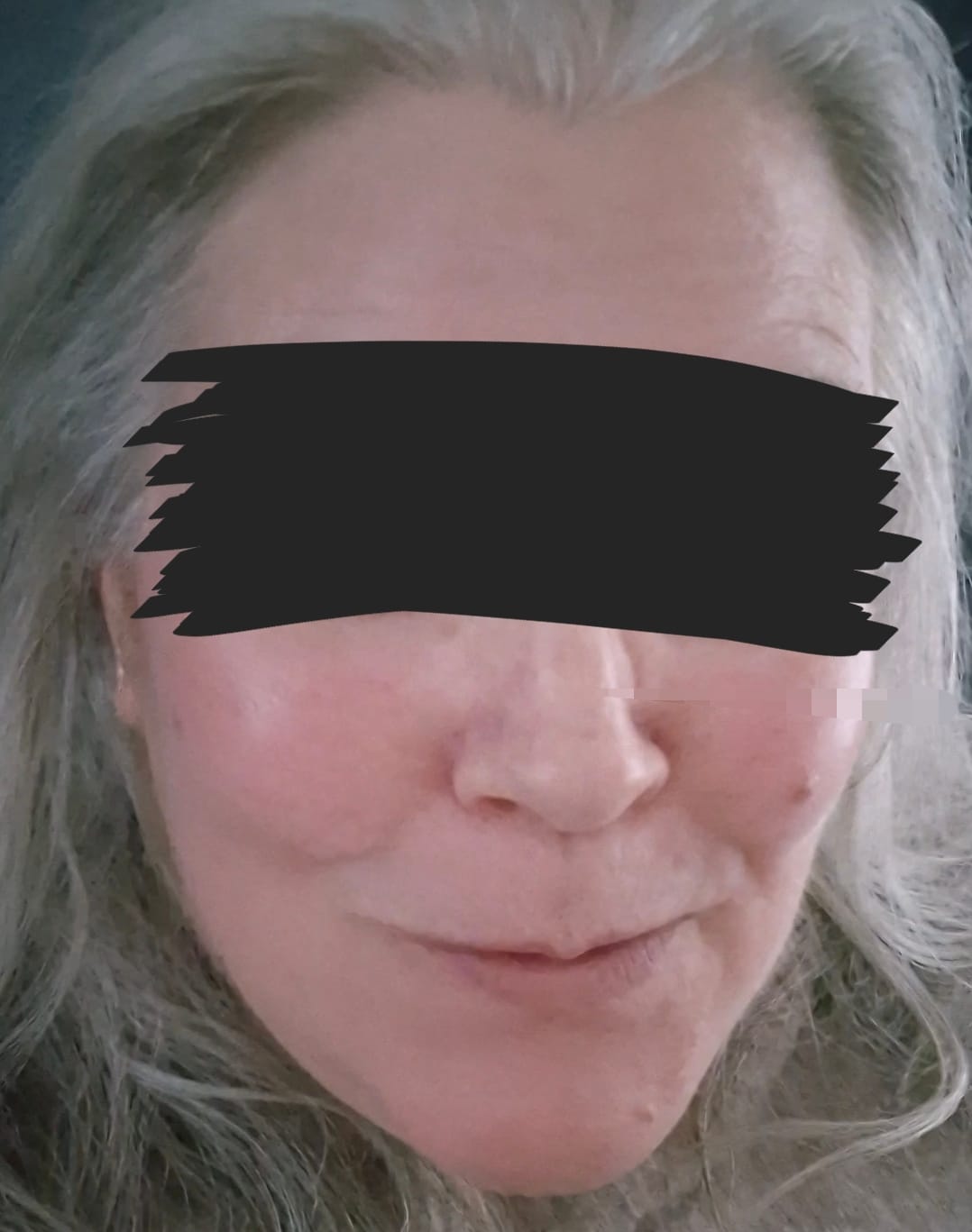 Customer photo review of The Potions Peptide ampull (20ml) - Øker kollagenproduksjon, revitaliserer og jevner ut hudtonen