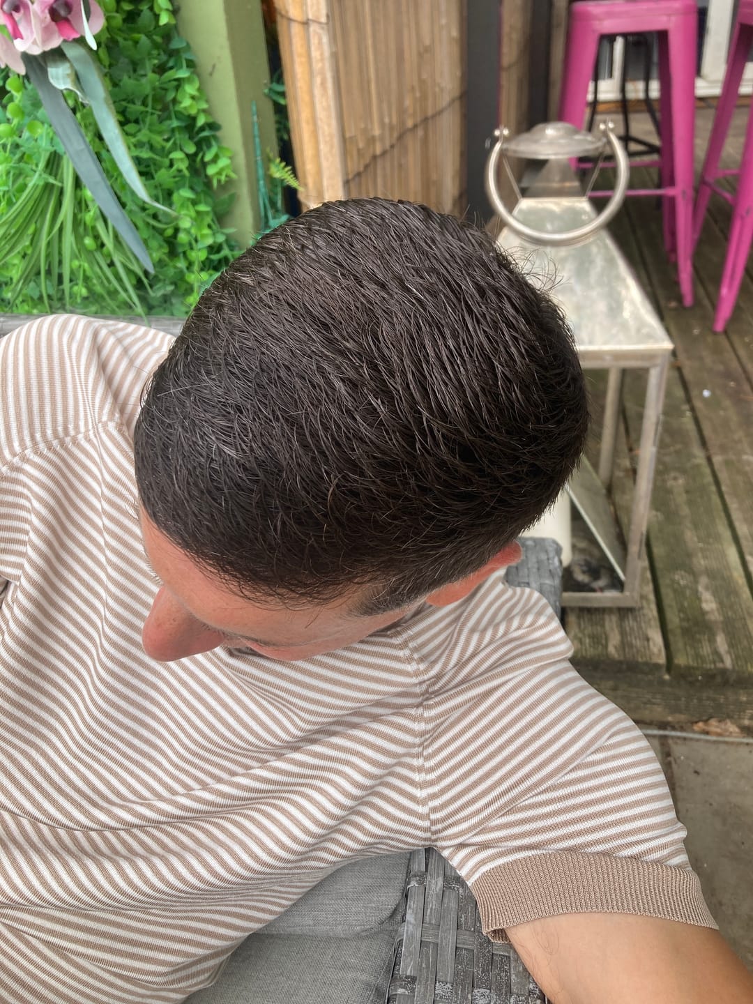 Customer photo review of LIVDOR Pro Laser Hair Growth Cap