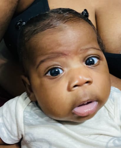 Customer photo review of Butterfly Growth™ Oil