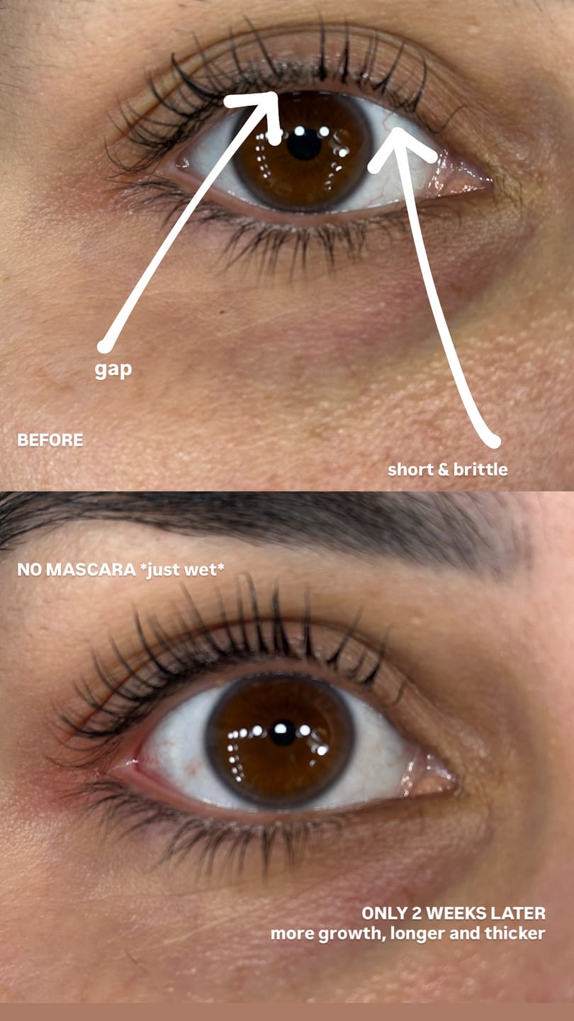 Customer photo review of NVDS Eyelash Growth Serum - Promote Healthy and Fuller Lashes