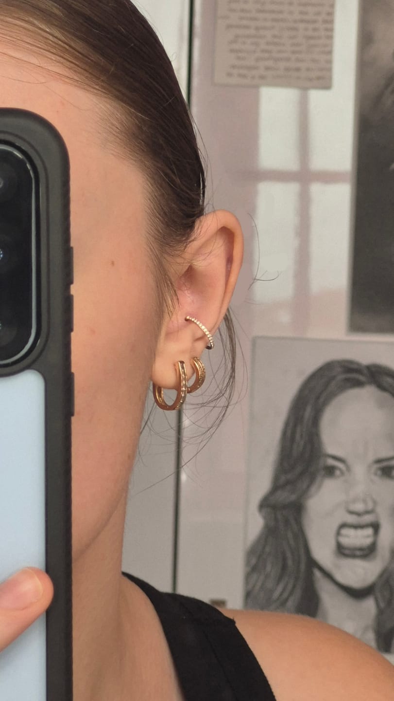 Customer photo review of ANGEL Eternity Cartilage Hoop (16g)