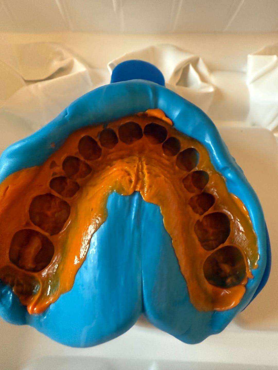 Customer photo review of Upper Impression Kit