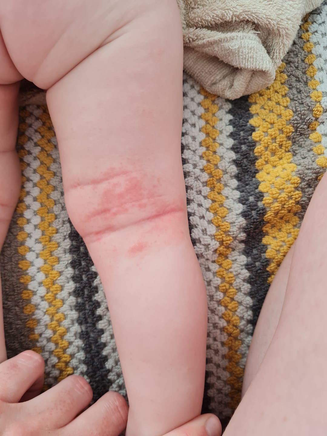 Customer photo review of Bioskin Junior Duo Pack
