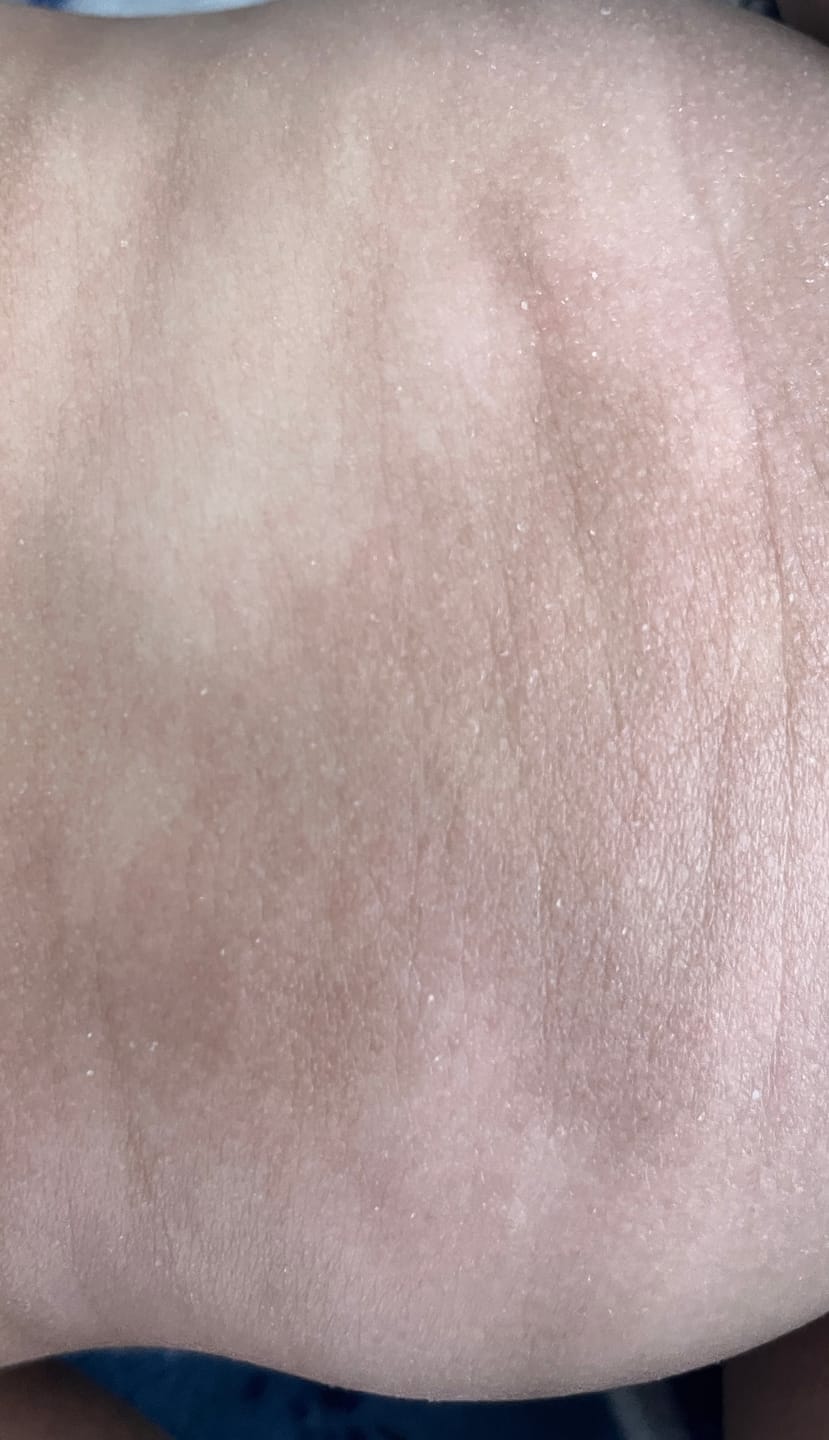 Customer photo review of Baby Bum Balm