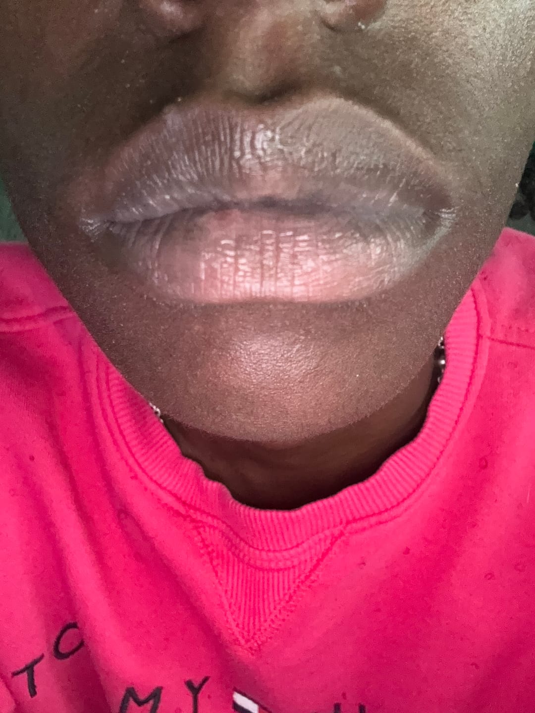 Customer photo review of Brightening Lip Bundle