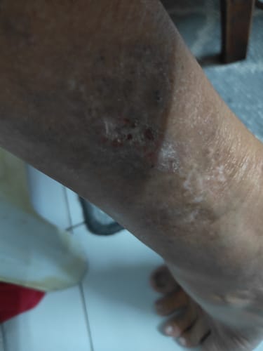 Customer photo review of Jolicare Cream