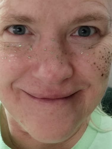 Customer photo review of Green Spirit Speckles Makeup Patches - Team Spirit Collection