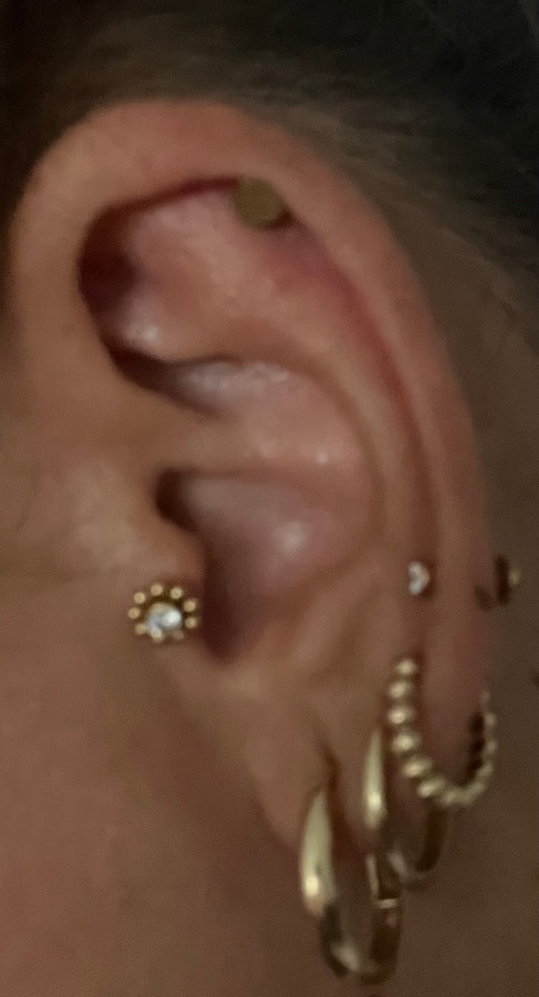 Customer photo review of Simple Stone Labret Piercing - Titan