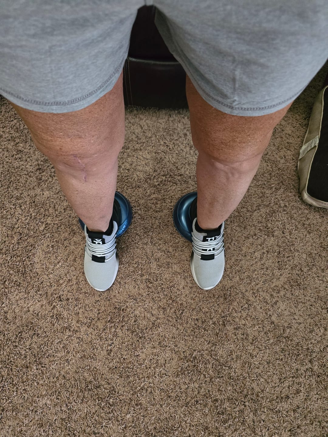Customer photo review of Balance Pods